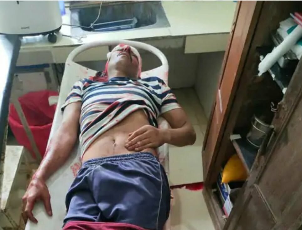 चलती बस में चली गोली, CRPF जवान की मौत, राइफल का ट्रिगर दबने से सिर में लगी गोली, एक जवान भी घायल