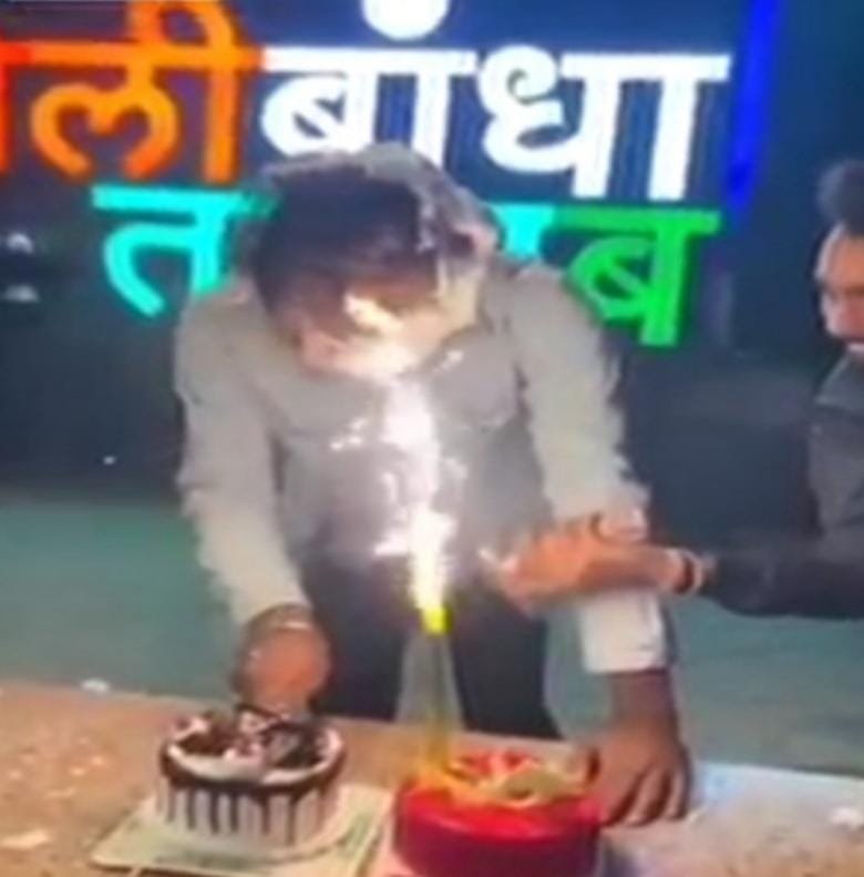 *केक काटते समय लपटों से झुलसा बर्थडे बॉय का चेहरा, यंगस्टर्स का जानलेवा जश्न, स्पार्कल कैंडल से भड़की आग*