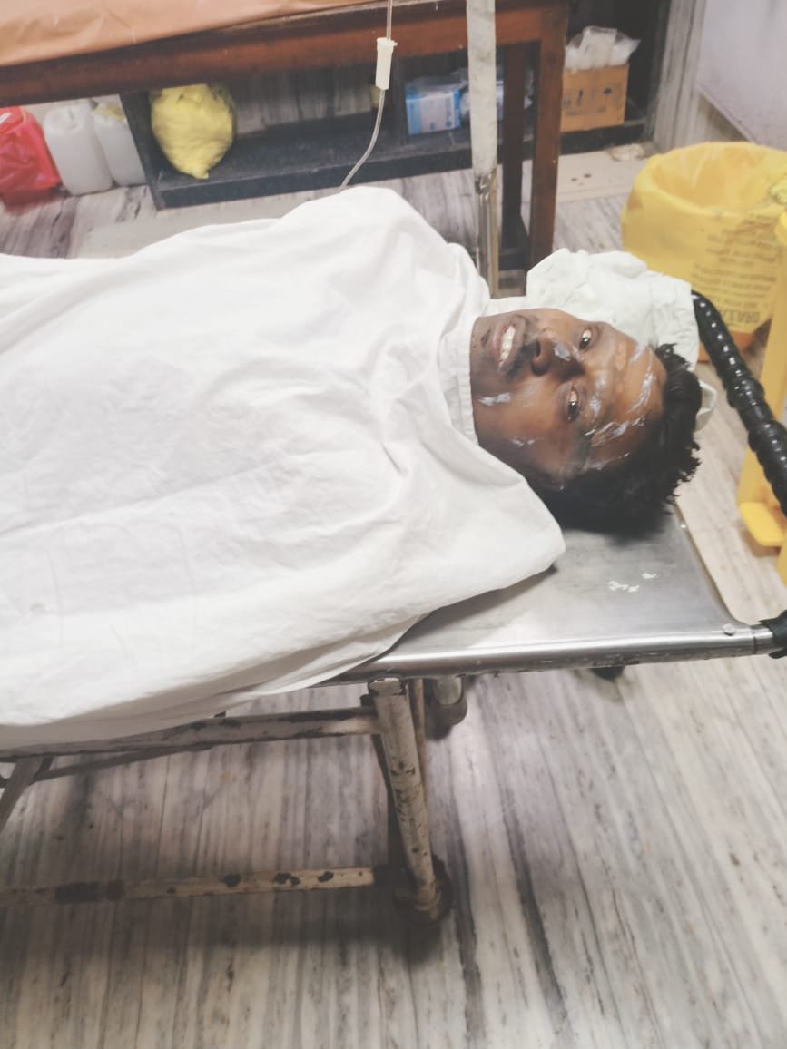 बीएसपी के ब्लास्ट फर्नेस क्रमांक 7 में मरम्मत कार्य के दौरान हुआ हादसा, दो ठेका श्रमिक झुलसे, एक की स्थिति गंभीर बीएसपी के ब्लास्ट फर्नेस क्रमांक 7 में मरम्मत कार्य के दौरान हुआ हादसा, दो ठेका श्रमिक झुलसे, एक की स्थिति गंभीर