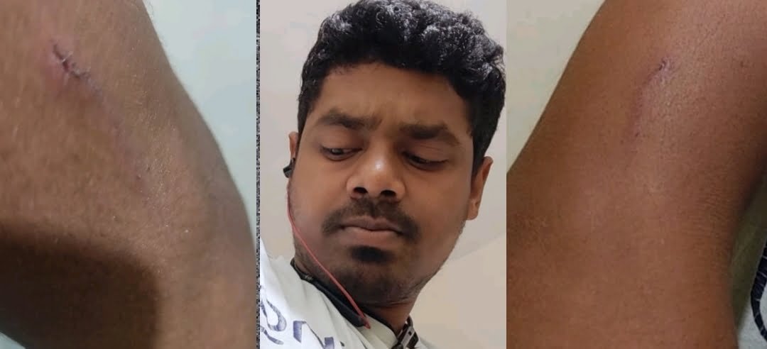 नेहरू नगर में वाय फाय कनेक्शन लगाने गए कर्मी को पाईप से पीटा, कहा-देर से क्यों आया?