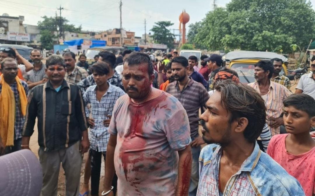 सुपेला में लोगों का आक्रोश, शराबी का सिर फोड़ा, डंडे से की पिटाई, आते जाते राहगीरों को मार रहा था डंडे से
