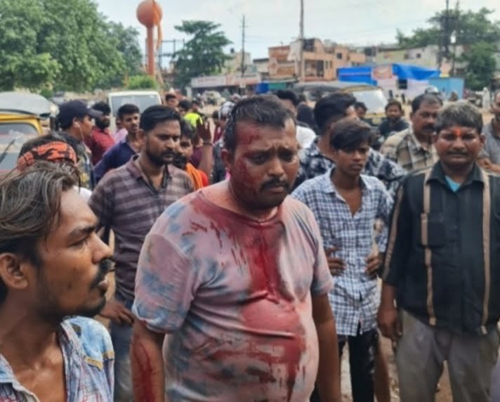 सुपेला शराब दुकान के पास सिर फुड़वाने वाले शराबी के खिलाफ बाइक सवार ने लिखाई रपट, जुर्म दर्ज सुपेला शराब दुकान के पास सिर फुड़वाने वाले शराबी के खिलाफ बाइक सवार ने लिखाई रपट, जुर्म दर्ज