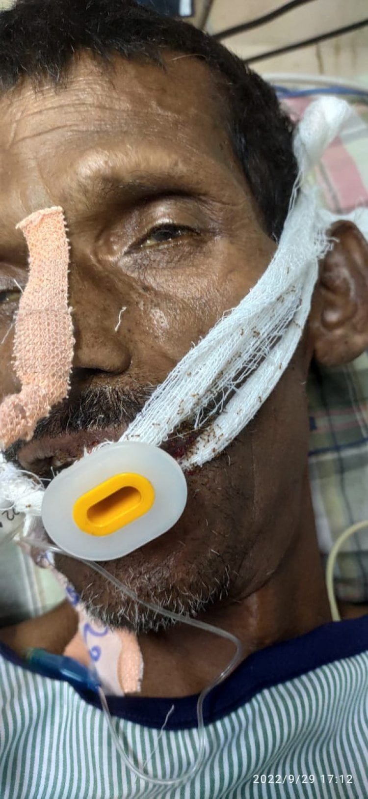 आईसीयू मरीज के चेहरे पर दौड़ रहीं थीं लाल चीटियाँ, आक्सीजन नली से रेंगती मरीज पर बना रही थीं कतार, डॉक्टर सहित चार की सेवा समाप्ति का सीएचएमओ ने दिया आदेश