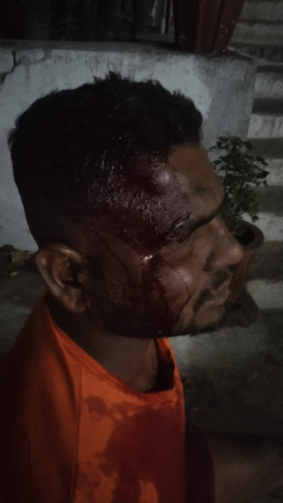 पुरानी रंजिशवश रॉड एवं डंडे से घर के बाहर खड़े युवक पर जानलेवा हमला, जीआरपी भिलाई थाने में अपराध दर्ज