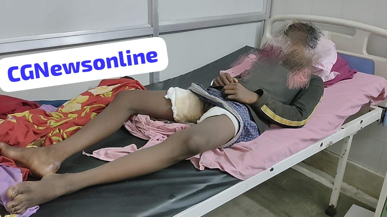 CG BREAKING NEWS : 🛑 नाबालिग पर पेट्रोल डाल जिंदा जलाने का प्रयास, गंभीर अवस्था में अस्पताल में चल रहा इलाज, 🔵 तीनों आरोपियों को सरगर्मी से पुलिस रही तलाश