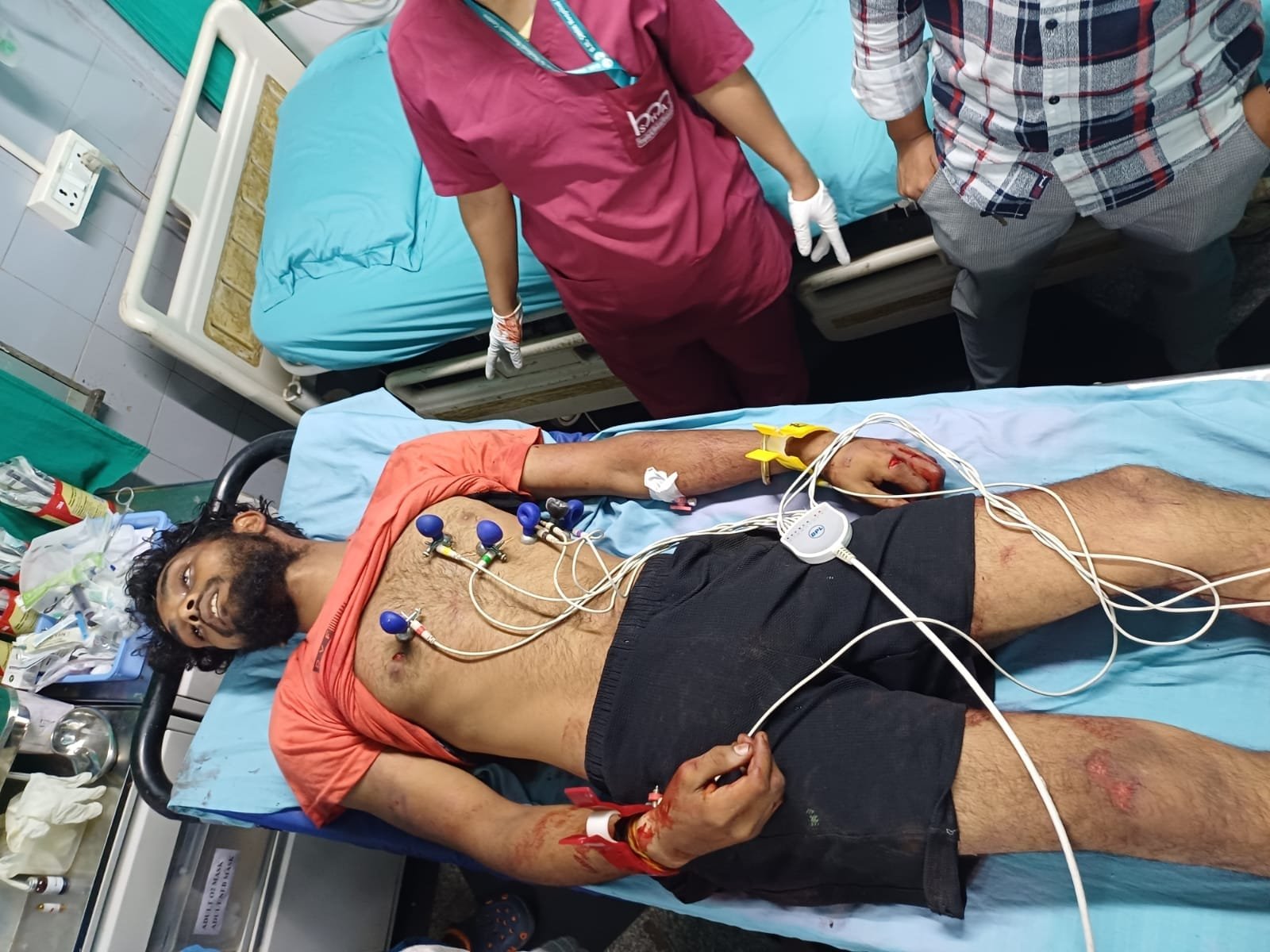 दुर्ग हत्या ब्रेकिंग : पद्मनाभपुर थाना क्षेत्र में चाकू बाजी, बोरसी के युवक की हत्या, तीन संदिग्ध हिरासत में, घटनास्थल से डंडे बरामद