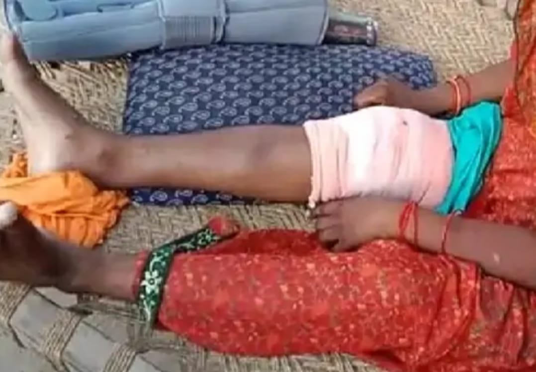 दबंगों ने महिला का बाल पकड़ घसीटते हुए पीटा, चीखते रहे बच्चे, विडियो वायरल होने के बाद जांच में जुटी पुलिस