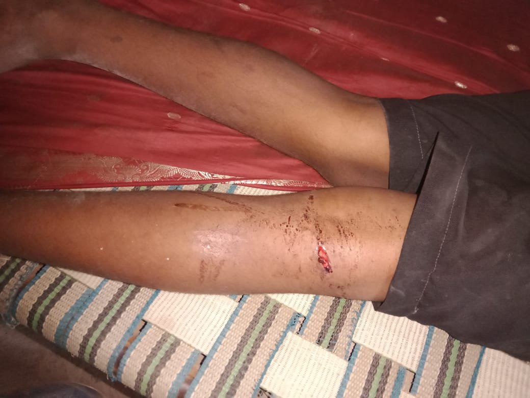 दुर्ग संभाग ब्रेकिंग : उत्तर प्रदेश की भांति आदमखोर सियार का छत्तीसगढ़ में आतंक, चार लोगों पर किया हमला एक बुजुर्ग की स्थिति गंभीर, सियार को पकड़ने वन विभाग का प्रयास जारी