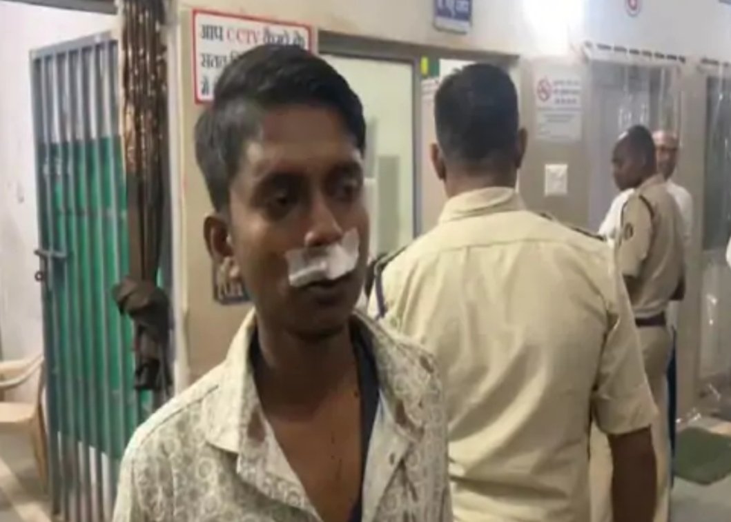 संपत्ति बंटवारे को लेकर सुपेला में दो भाइयों के परिवार में खूनी संघर्ष संपत्ति बंटवारे को लेकर सुपेला में दो भाइयों के परिवार में खूनी संघर्ष