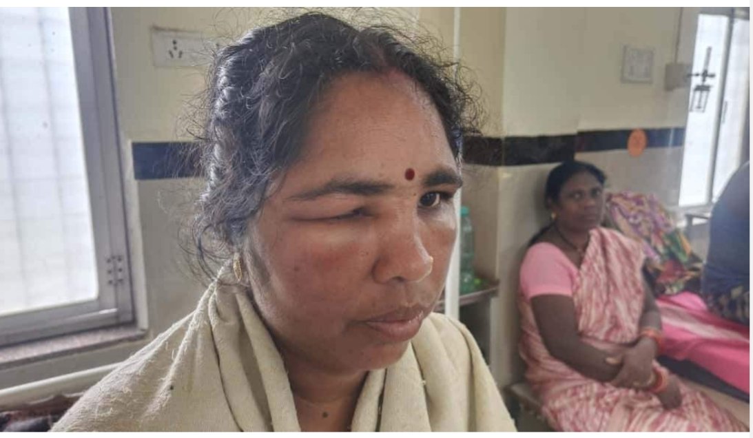 दुर्ग संभाग ब्रेकिंग : मधुमक्खी के हमले में दो लोगों की मौत, महिला सहित 06 जख्मी
