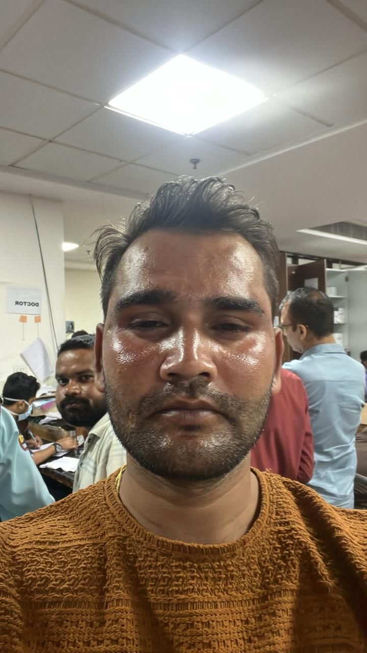 राजधानी रायपुर में सटोरियों का आतंक, वसूली के लिए जमकर पीटा युवक को राजधानी रायपुर में सटोरियों का आतंक, वसूली के लिए जमकर पीटा युवक को