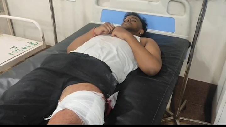 Durg में आपसी विवाद के बाद चाकू बाजी, एक युवक घायल, जिला अस्पताल में भर्ती