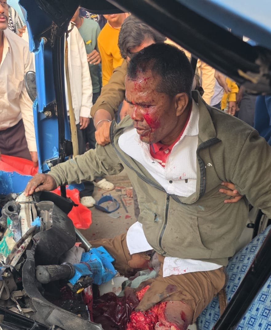 रायपुर VIP रोड पर खौफनाक सड़क हादसा, ई रिक्शा चालक का पैर कटकर अलग रायपुर VIP रोड पर खौफनाक सड़क हादसा, ई रिक्शा चालक का पैर कटकर अलग
