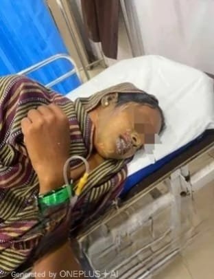 Durg : कांवड़ यात्रा से लौट रही महिला पर एसिड अटैक, दो बच्चे भी झुलसे;